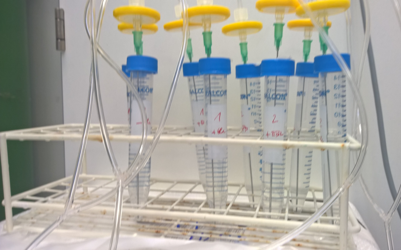 Several vials filled with liquid