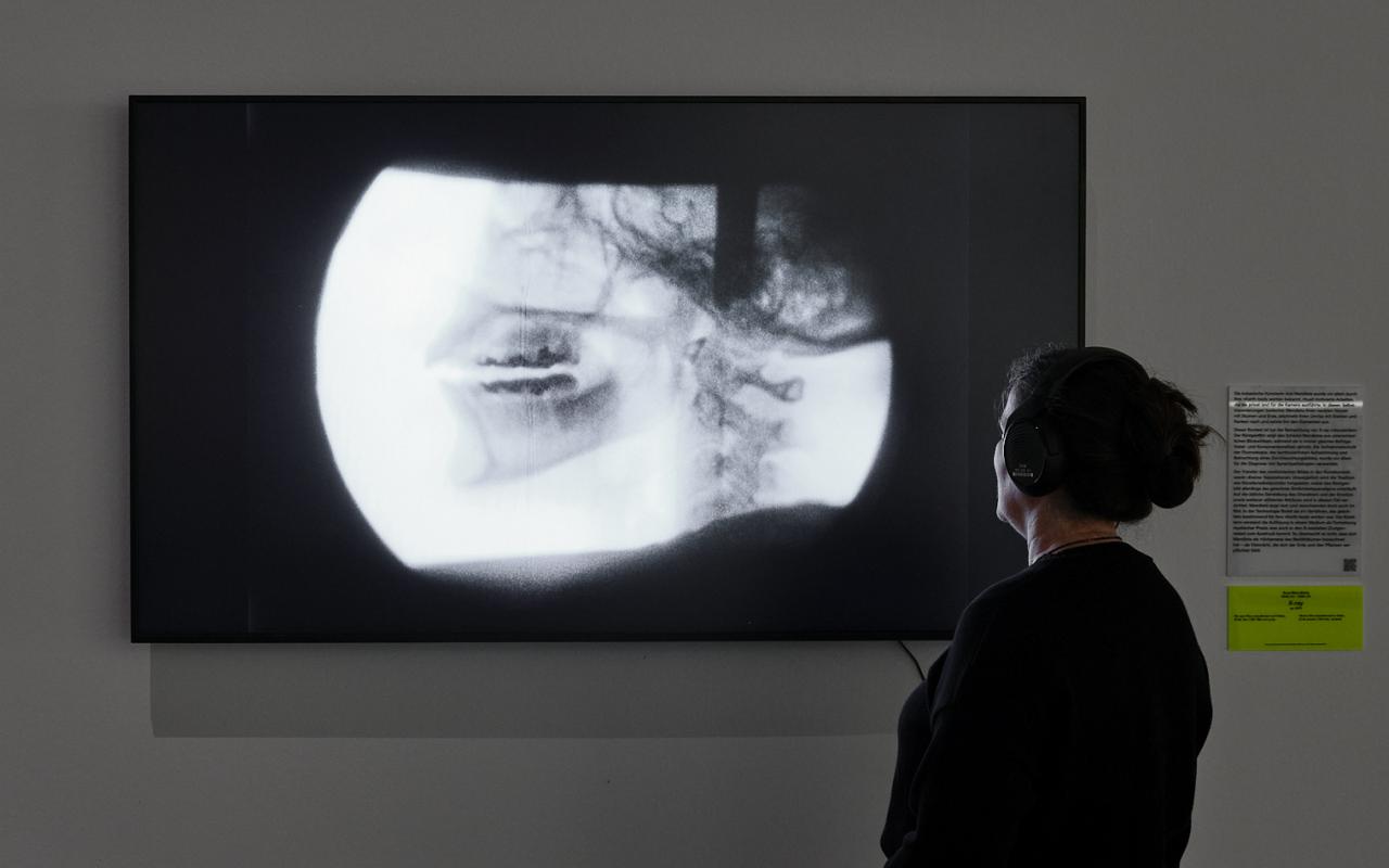 »X-ray« von Ana Mendieta. Zu sehen ist eine Person vor einem Bildschirm. Auf ihm ist eine kreisförmige Röntgenaufnahme abgebildet