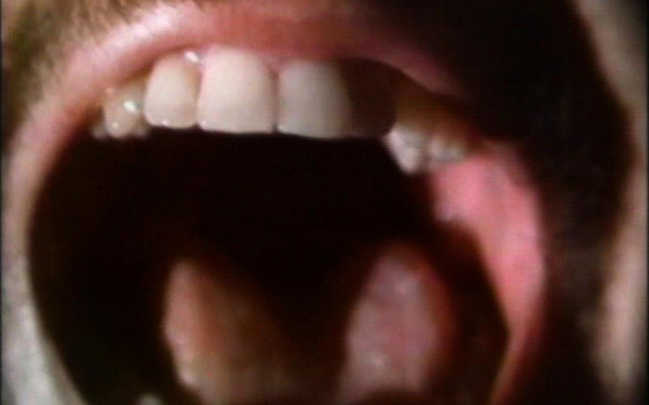Werk - The Space Between the Teeth