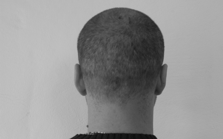 Black and white image of the back of a head