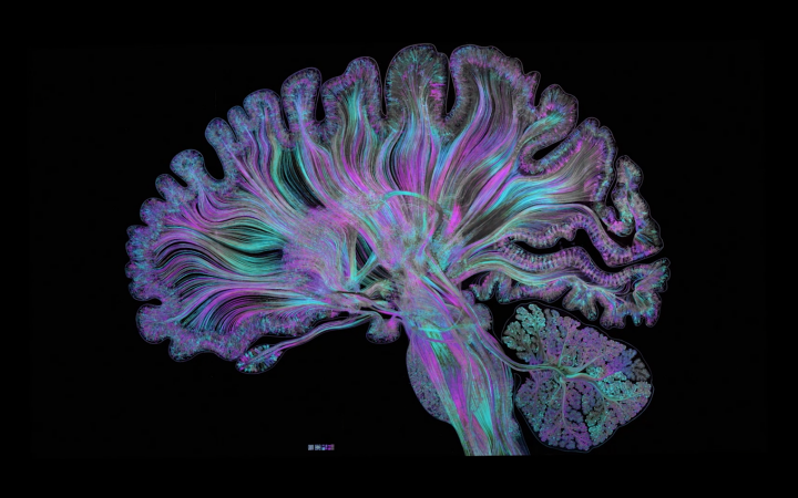 Farbige Darstellung eines Gehirns