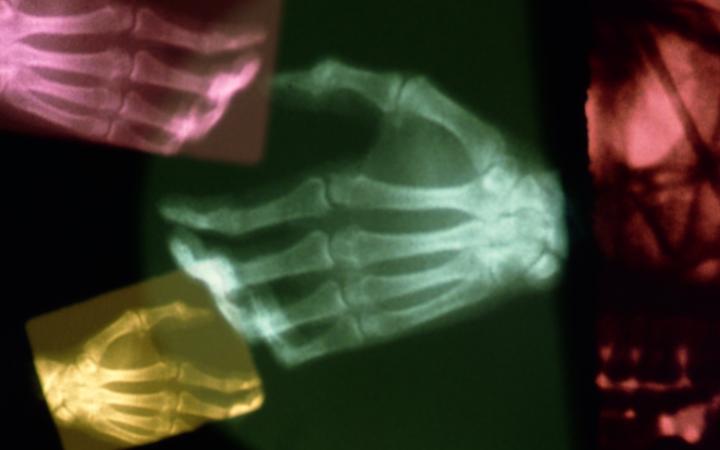 Zu sehen sind drei Röntgenaufnahmen von Händen in jeweils rosa, gelb und grün vor einem schwarzen Hintergrund.