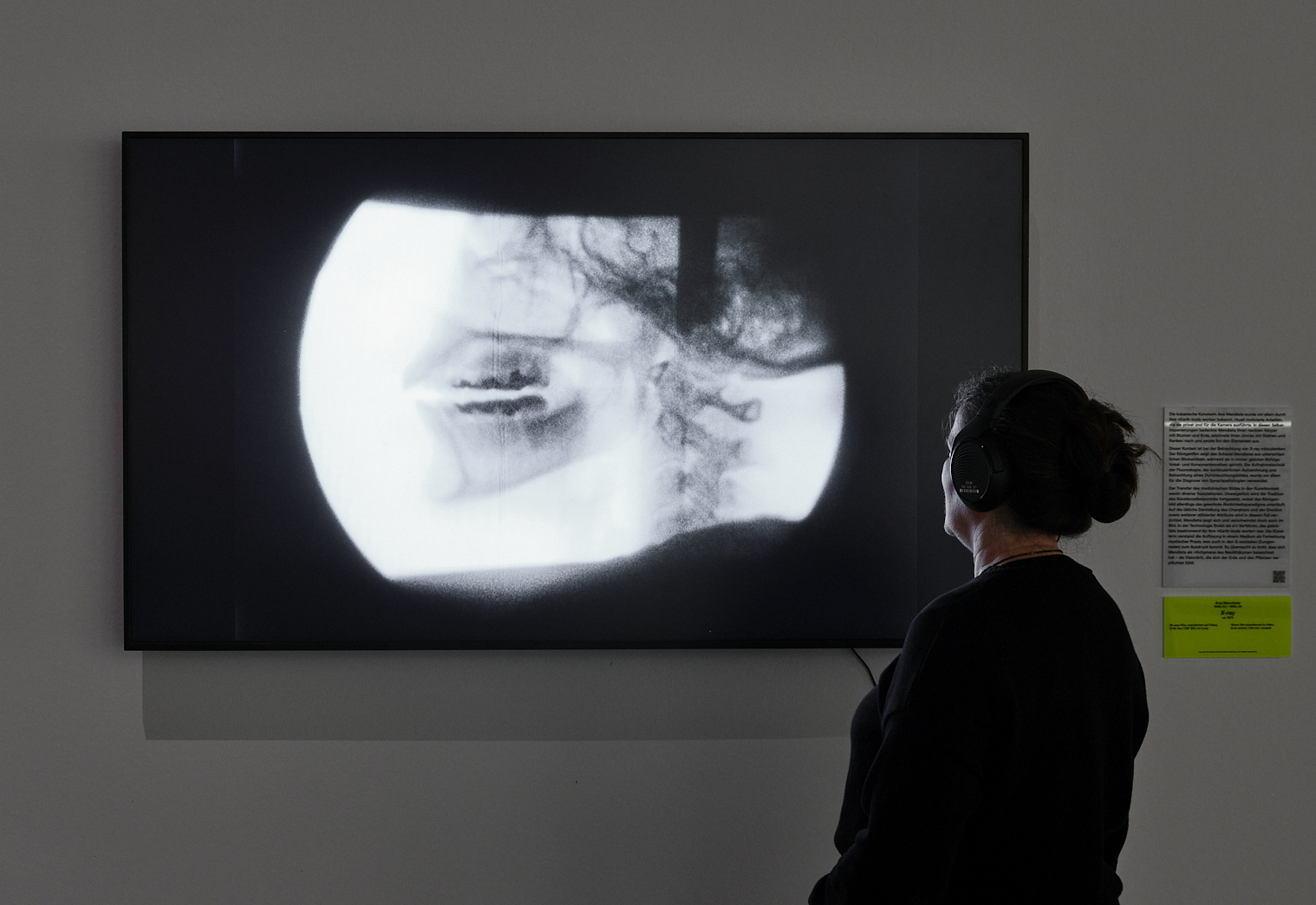 »X-ray« von Ana Mendieta. Zu sehen ist eine Person vor einem Bildschirm. Auf ihm ist eine kreisförmige Röntgenaufnahme abgebildet