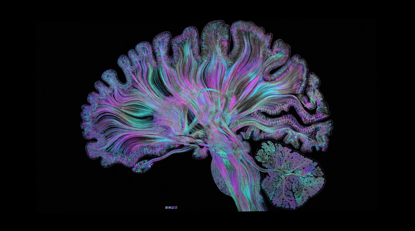 Colored representation of a brain