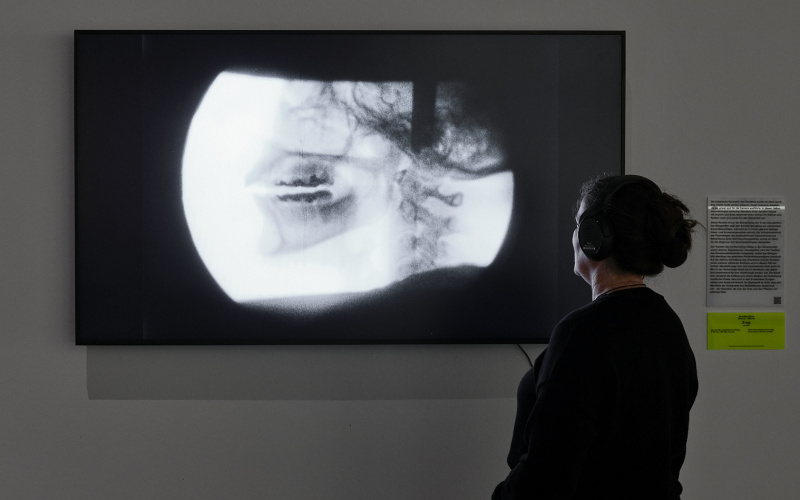 »X-ray« von Ana Mendieta. Zu sehen ist eine Person vor einem Bildschirm. Auf ihm ist eine kreisförmige Röntgenaufnahme abgebildet