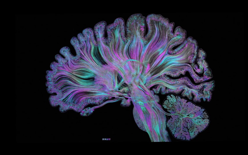 Colored representation of a brain